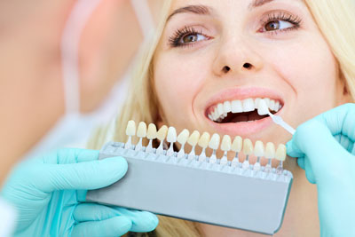Veneers Dentist