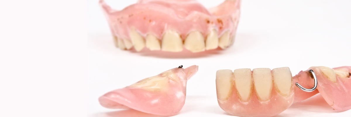 Wantagh What Do I Do If I Damage My Dentures?