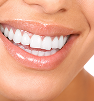 Teeth Whitening Services Wantagh, NY