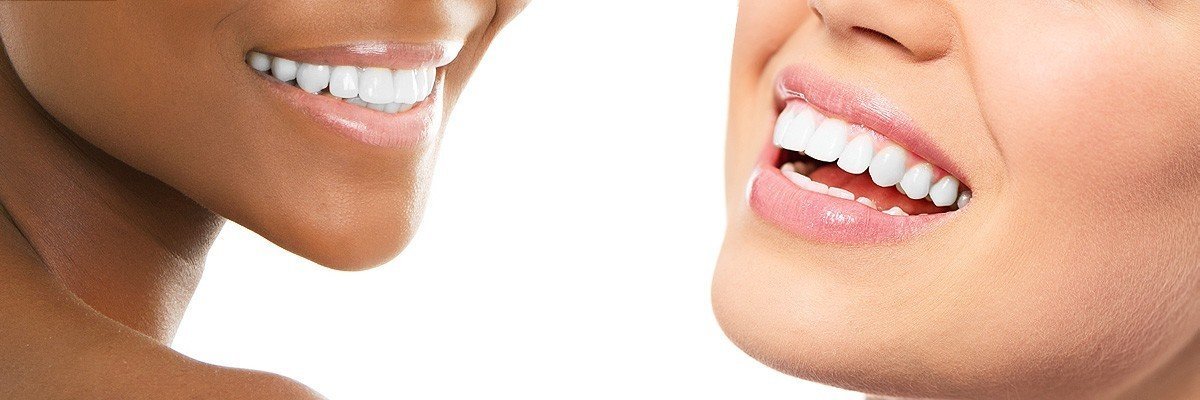 Wantagh Dental Restoration
