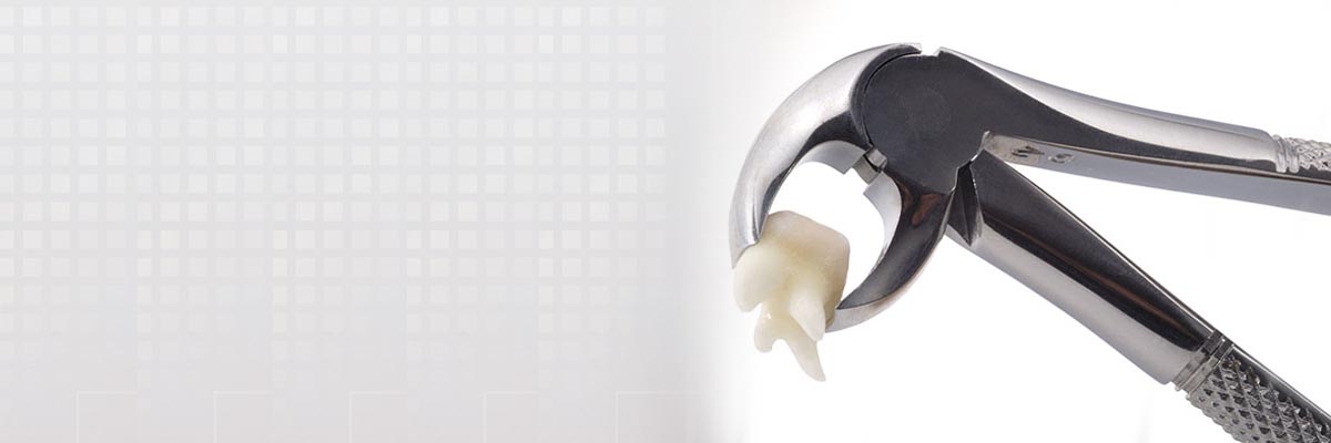 Wantagh Tooth Extraction