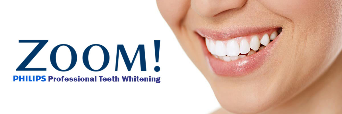 Wantagh Zoom Teeth Whitening